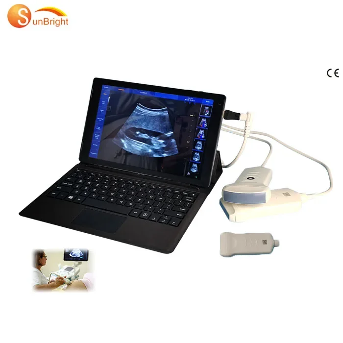 Medical USB Color Doppler Linear Ultrasound Probe Machine Scanner