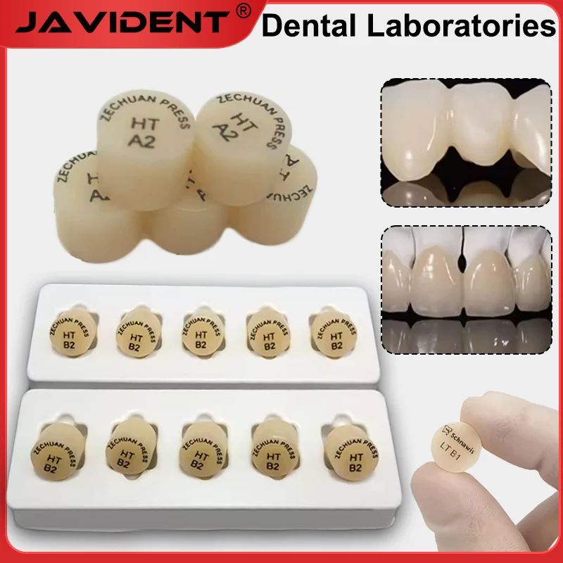 Dental Prosthetics …