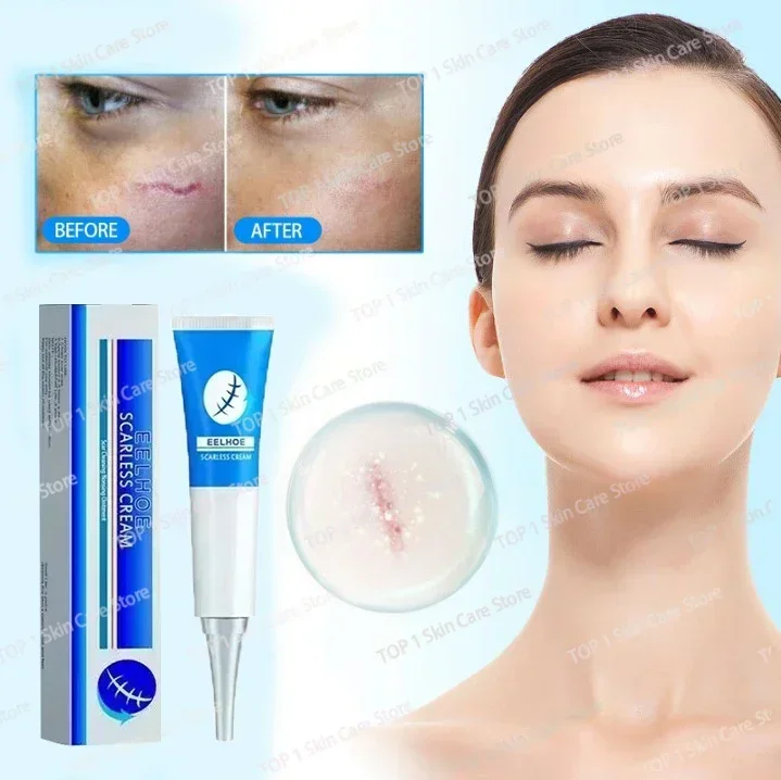 

Women's Beauty And Scar Removal Keeps The Face Moisturized And Repairs Damaged Skin Scar Postoperative scar repair 1006