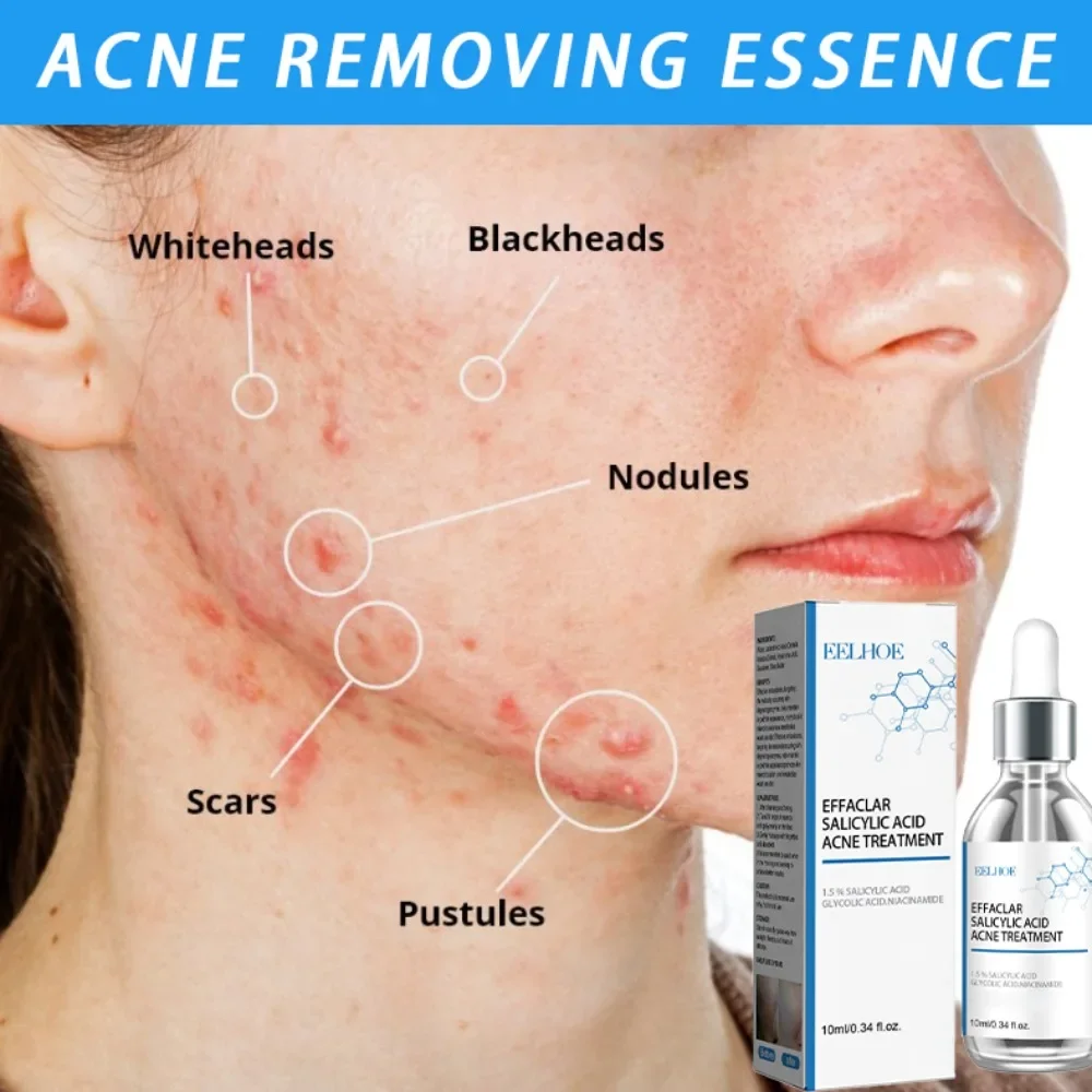 

Facial acne removal serum lasts for long-term moisturizing and shrinking old holes moisturize the skin, making your skin smooth