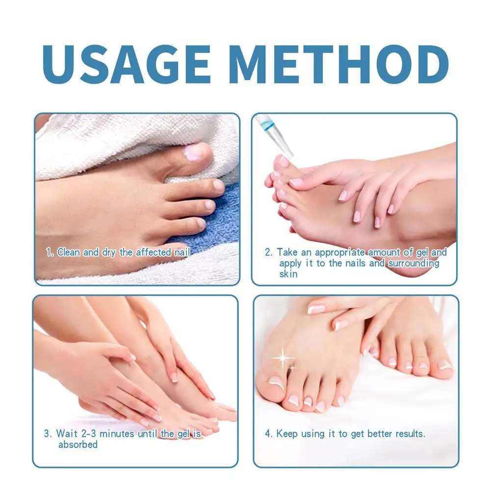 Caneta indolor do reparo do prego, Serum do reparo das unhas dos pés, Anti cuidado para mais grosso quebrado, N9F7 descolorido