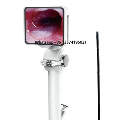 Medical Hospital and Veterinary 2.8mm/3.8/4.8mm Portable Video ENT Flexible Endoscope