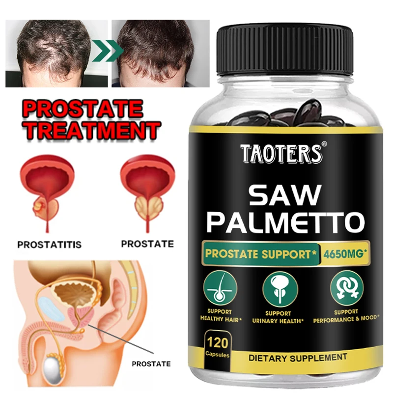 Saw Palmetto Capsules for Men Prostate Health Supplement Supports Urinary Tract Health Supports Bladder Health Promotes Hair Gro