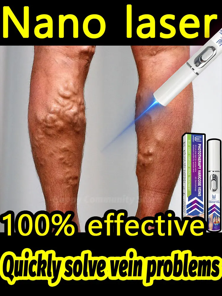 

ᴺᵃⁿᵒ ˡᵃˢᵉʳ ᴿᵉˡⁱᵉᵛᵉ ᵛᵃʳⁱᶜᵒˢᵉ ᵛᵉⁱⁿˢ‧