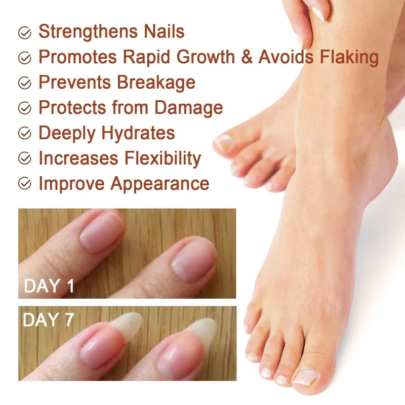 7Days Nail Repair Essence Repair Ingrown Toenails Thickening Onychomycosis Relieve Toenail Pain Hand Foot Nail Repair Serum