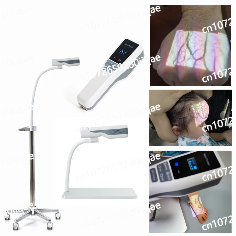 Medical facial pediatric varicose vein imaging handheld station mobile stent vein detector