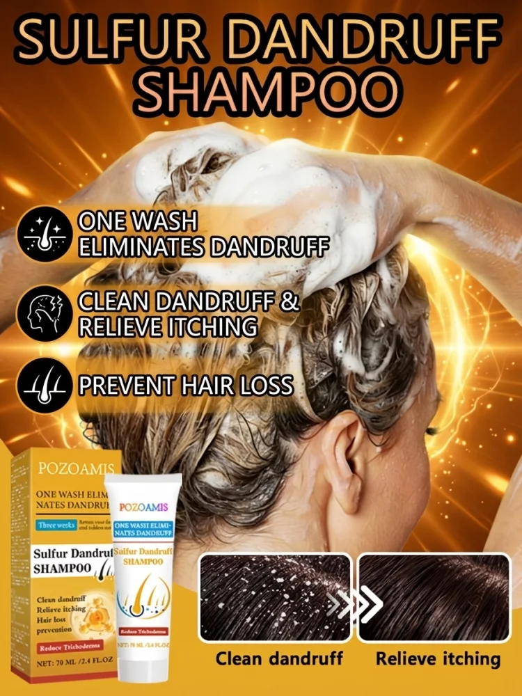 

Серный шампунь от перхоти для глубокого очищения жирной кожи головы, при стойкой рецидивирующей перхоти, себорейном воспалении, покраснении, раздражении и зуде.