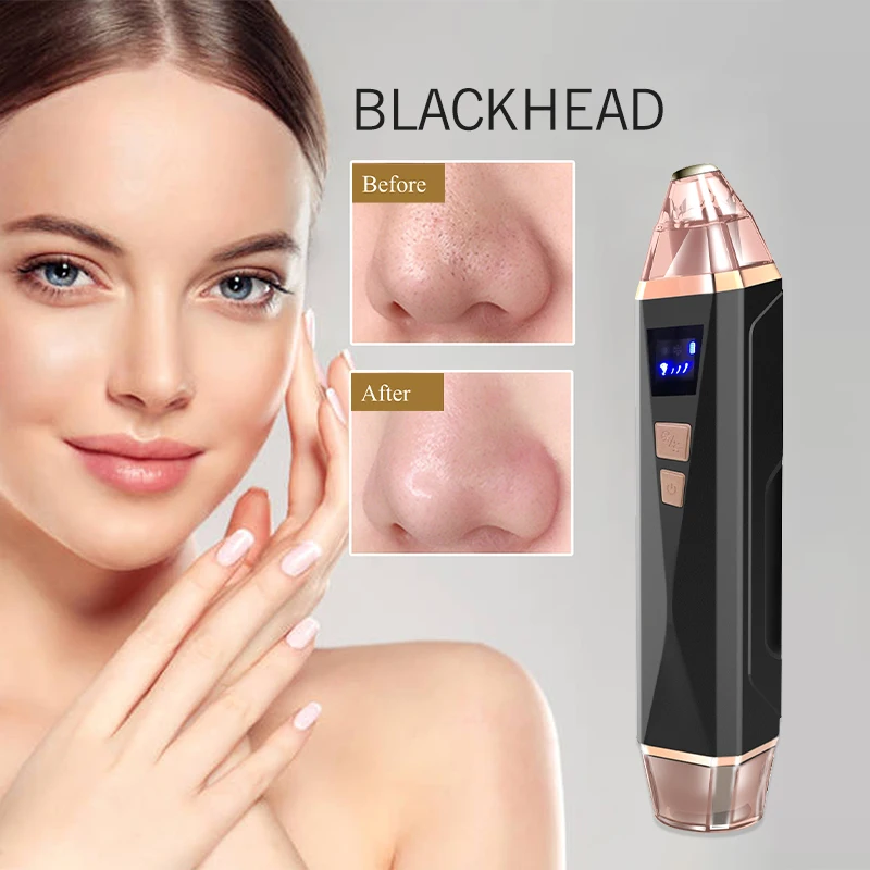 高品質電動ブラックヘッド除去器 毛穴クリーナーマシン バキューム式黒ずみ除去 毛穴吸引器 フェイスクリーナー