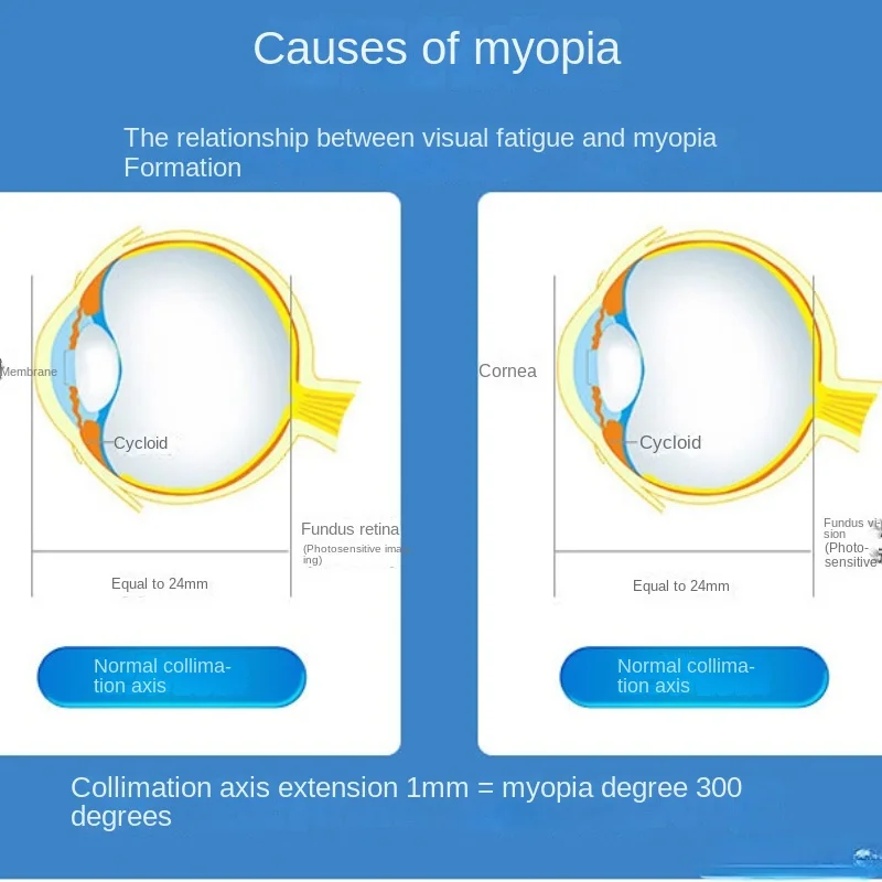 Free Shipping Myopia Instrument Eye Massage Astigmatism Eye Fatigue Instrument Eye Protection Vision Protection Eye