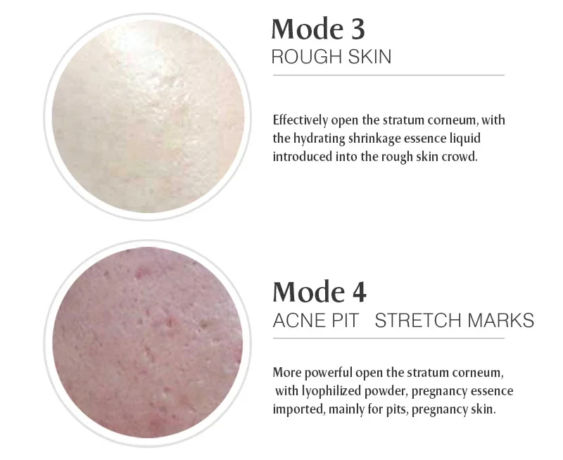 Ultima Dr.imp Pen Wireless Derma Rolling Digital 5-Gang Dermapen Microneedling-Kartusche Mesotherapie Elektrisches Schönheitspflege-Tool – Detail 9