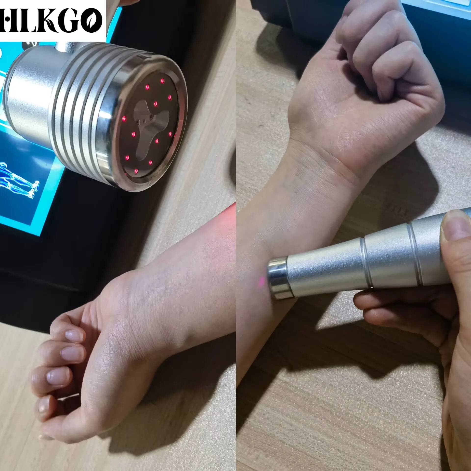 

Высокомощный лазерный терапевтический аппарат класса IV 1055 мВт для обезболивания, 650 нм и 808 нм, с двойной длиной волны, портативный, для реабилитации