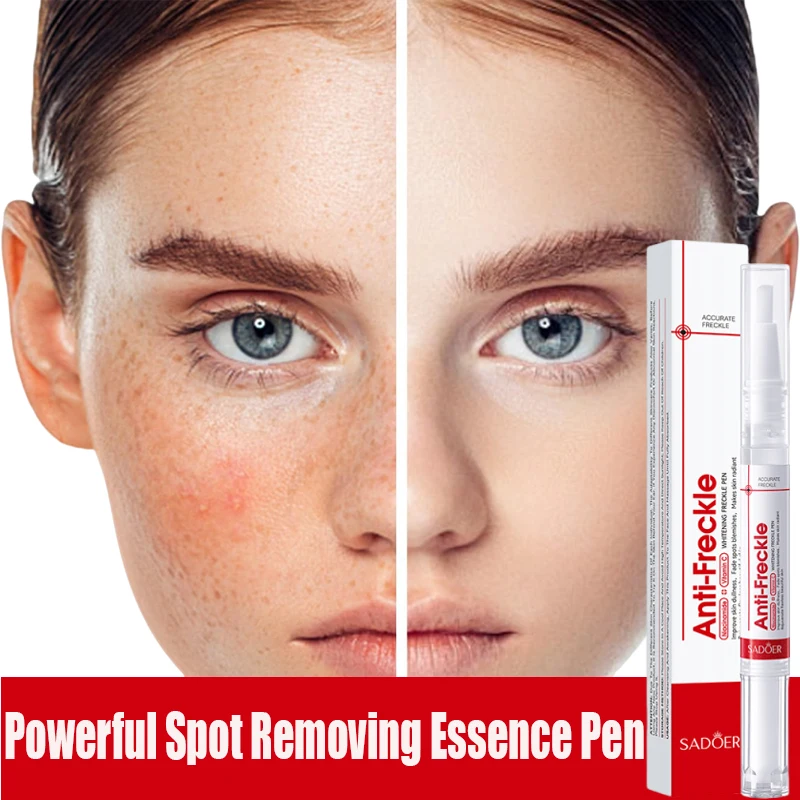 

Whitening Freckle Pen Niacinamide Remove Dark Spot Serum Anti Freckle and Aging Cream Fade Pigmentation Melasma Skin