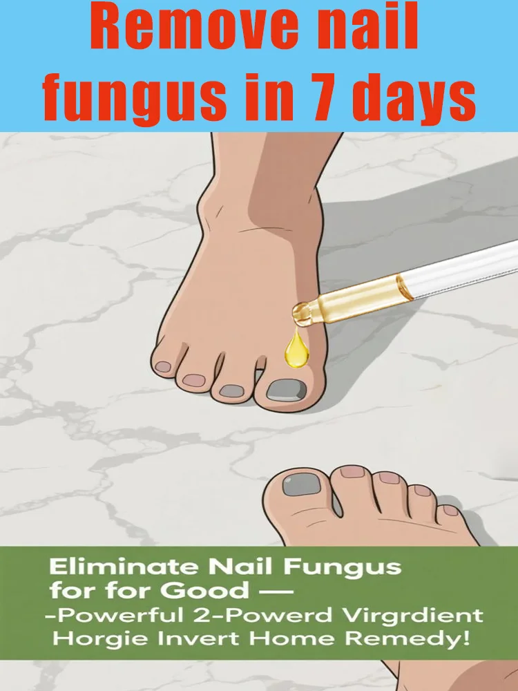 Verabschieden Sie sich von Onychomykose, keine Wiederholung, keine Schäden an Nägeln.