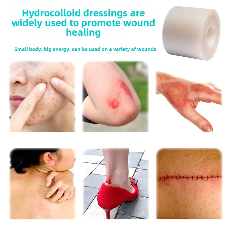 خلع الملابس الغروانية المائية الجلد الاصطناعي لفات الغروانية المائية رطبة منع العدوى الجرح شفاء امتصاص التصحيح ضمادة #6