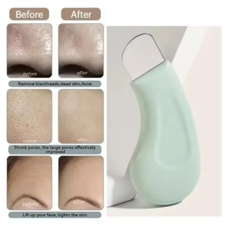1/4pcs mix Stainless Steel Face New beauty shovel knife Nose Blackhead Deep Cleansing Skin Care Remover