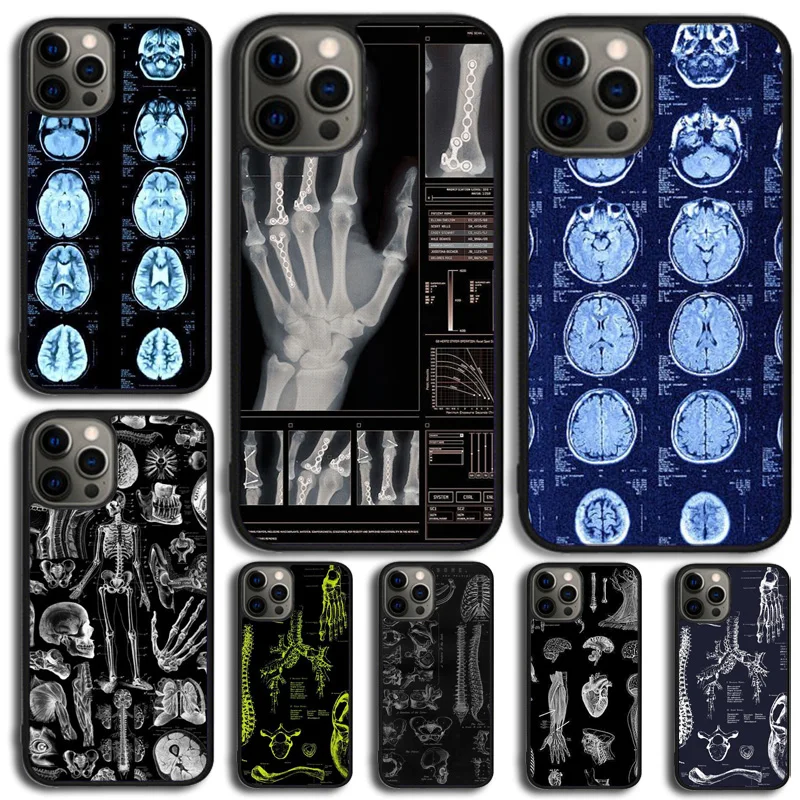 Radiological Human Organs Skeleton Phone Case For iPhone 14 15 16 13 12 Mini For Apple iPhone 11 Pro Max 6 8 7 Plus SE2020