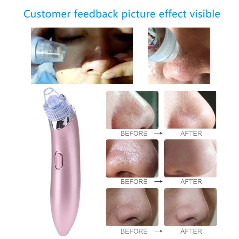 Blackhead Remover Face Deep Nose Cleaner T Zone Pore Acne Pimple Removal Vacuum Suction Facial Diamond Beauty Clean Skin Tool