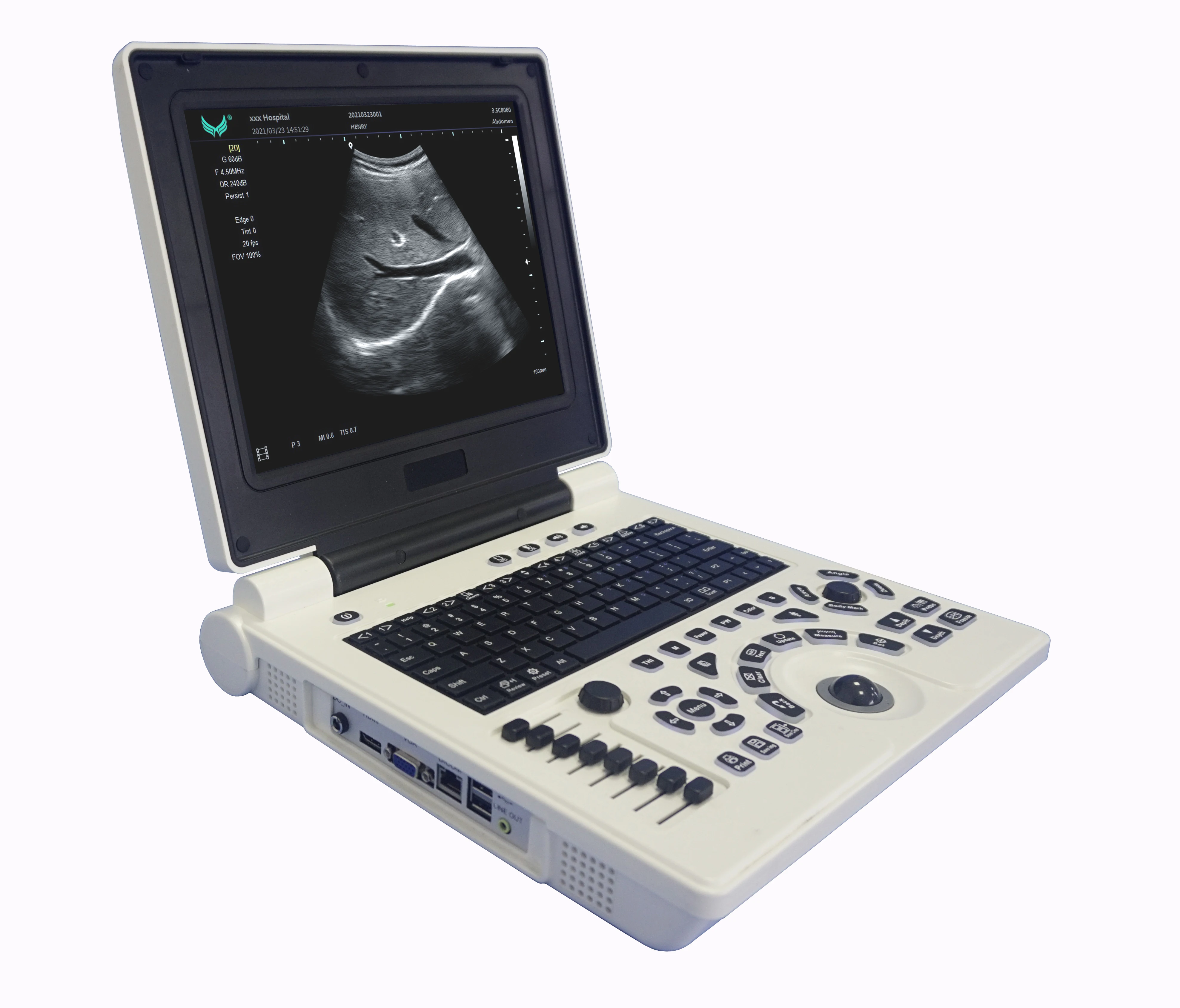 Cheap BW ultrasound scanner with THI PW 3D for human or Veterinary software optional