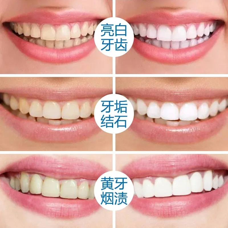 Men Ngọc Trai Răng Bột Rửa Răng Tự Nhiên Chất Làm Trắng Răng, Kem Đánh Răng Làm Trắng Răng Bột Tẩy Rửa Vết Bẩn, Chăm Sóc Răng Miệng