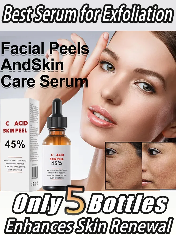 Face Care Exfoliating Peeling Oil Chemical Peel Pigmentation Lightening Melanin Acne Treatment Remove Scar Yellow Peeling Oil