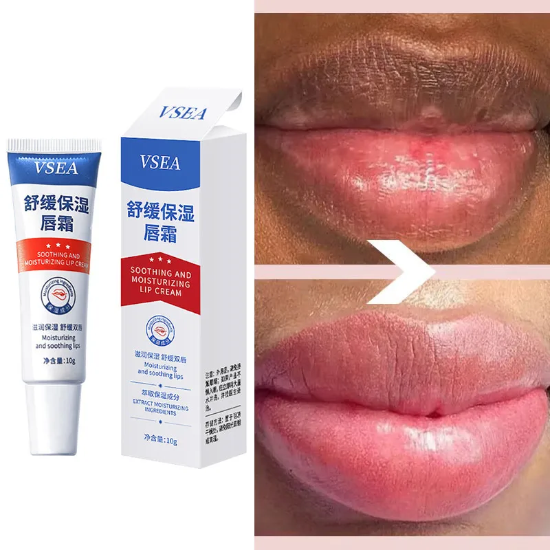 Remove Dark Lip Balm Fast Lightening Pink Lip Exfoliating Fade Lip Line Dead Skin Moisturizer Korean Care Lip care for Products