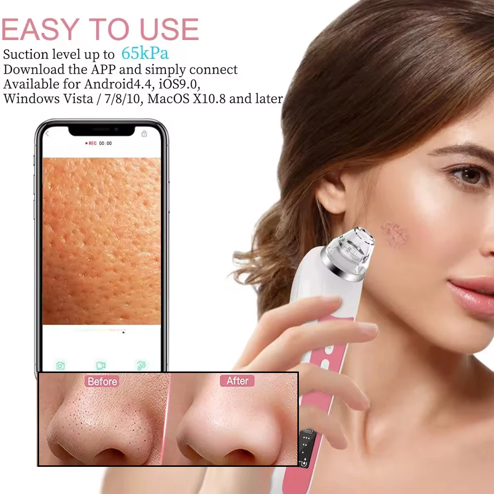 Electric Visual Blackhead Remover Vacuum Pore Cleaner Face Acne Pimple Extractions Tool with Camera 6 Suction Heads Skin Care