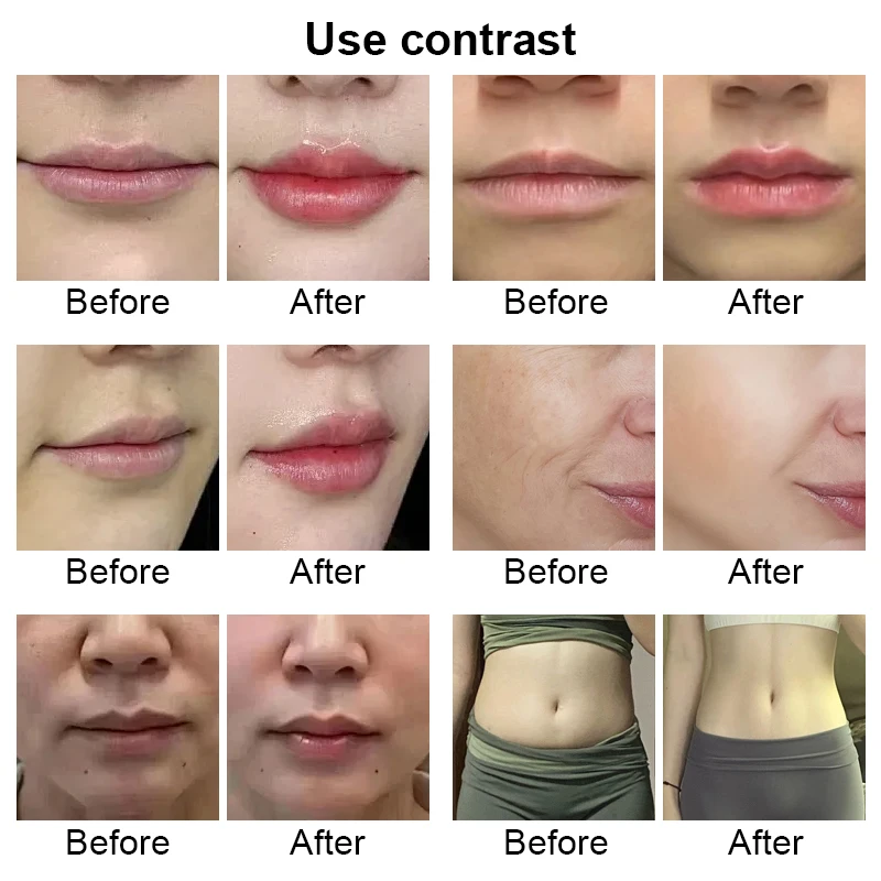 2in1 Hyaluron Pen Kit 0.3ML 0.5ML Atomizer Adjustable Pressure Pen Lip Augmentation Face Wrinkle Remover Belly Slimming Skin