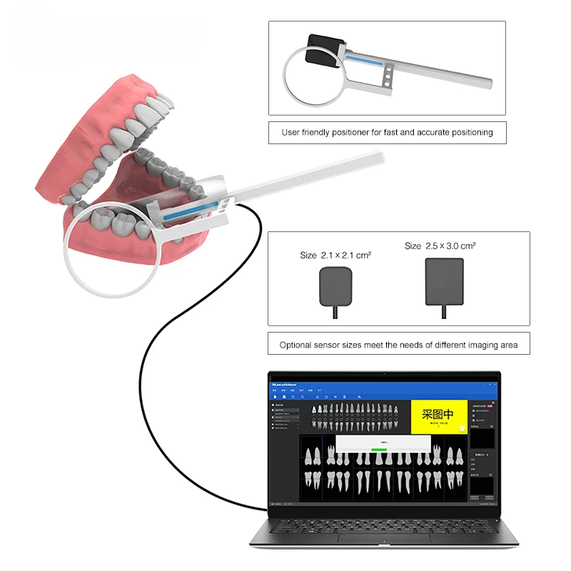 VVDental Dental Sensor Radiovisiograph rentgenowski Czujnik cyfrowy System obrazowania wewnątrzustnego Obraz HD Przenośny czujnik Rvg Narzędzie