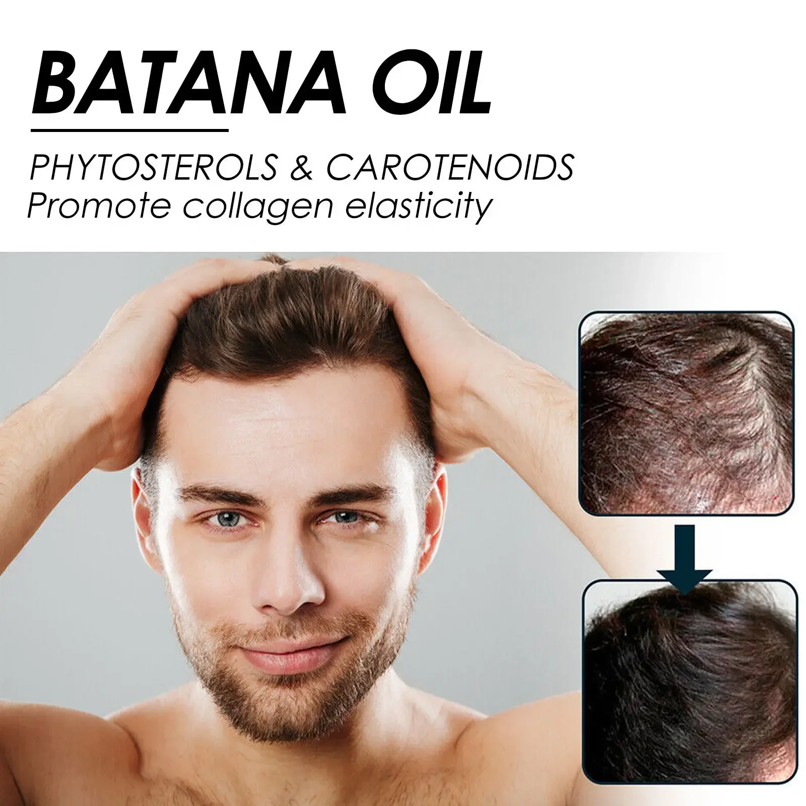 Sdatter African Batana Oil Hair Growth Spray Repair Baldness Hereditary Hair Loss Treatment moisturize the scalp aceite para el