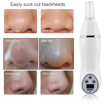 2026 Diamond Microdermabrasion Beauty Device Facial Deep Cleansing Pore Cleaner Handheld…