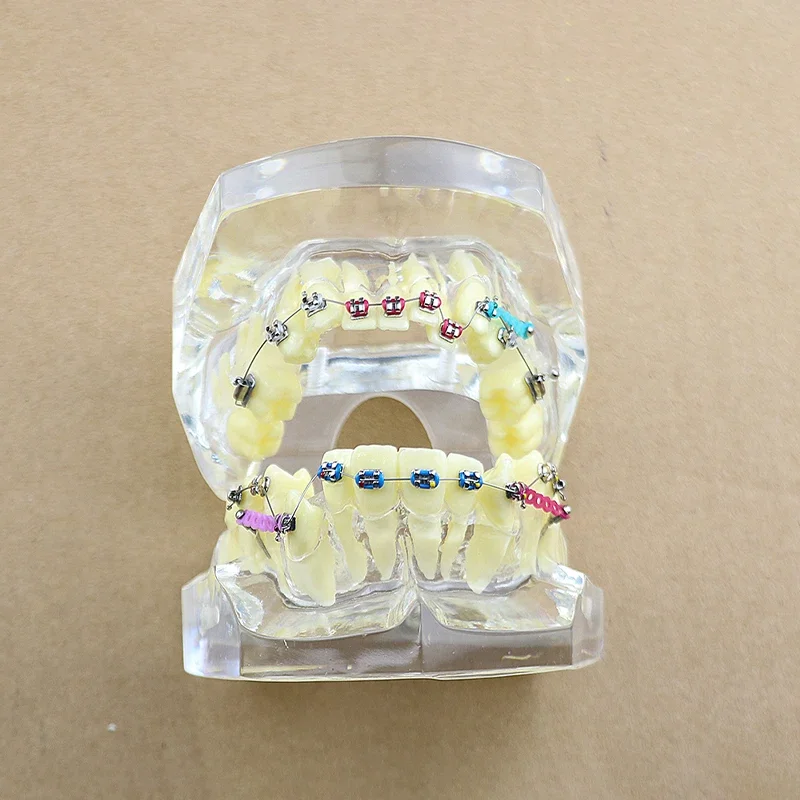 

Dentist Material Malocclusion Orthodontic Model Transparent Teeth Model for Studying