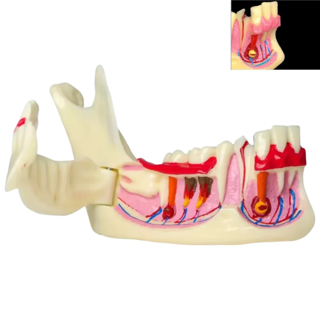 

1 шт. Стоматологическая модель нижней челюсти с эндодонтическими элементами, правая нижняя челюсть, анатомия десны, учебная демонстрационная модель для стоматологов, инструмент для изучения зубов
