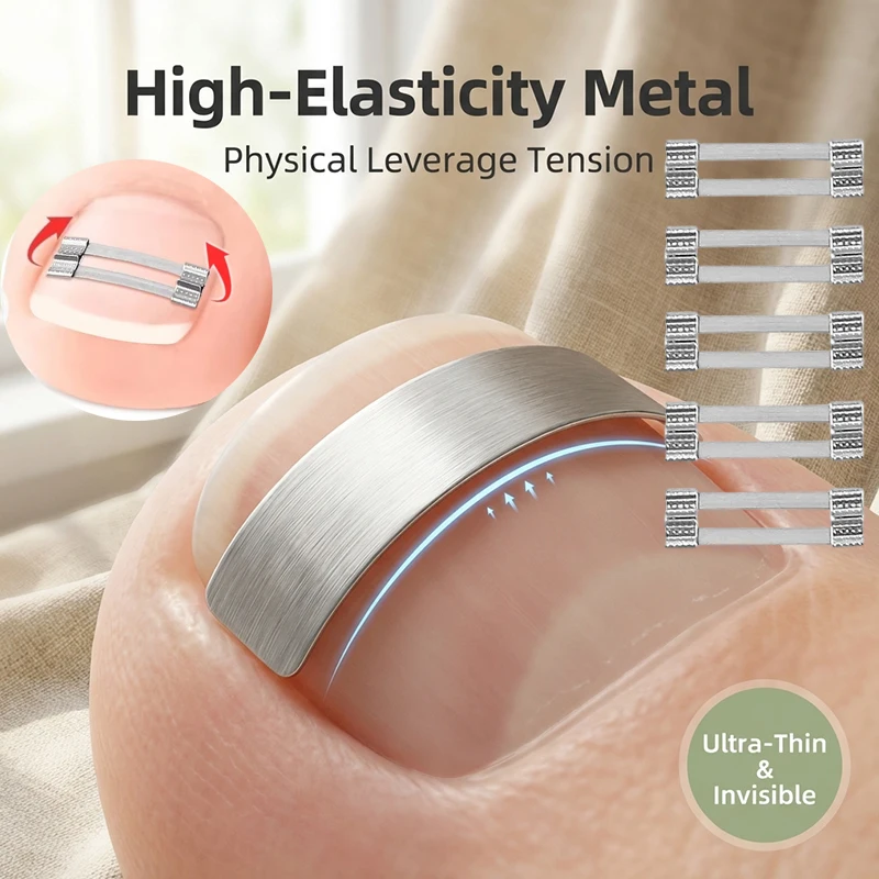 2Size Ingrown Toenail Corrector Clips Brace Tools Pedicure Recover Embed Toes Nail Treatment Professional Toenail Straightenings