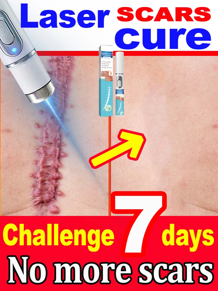 Scar Care Product - Solution for Mark Removal - Try This Scar Reduction Treatment