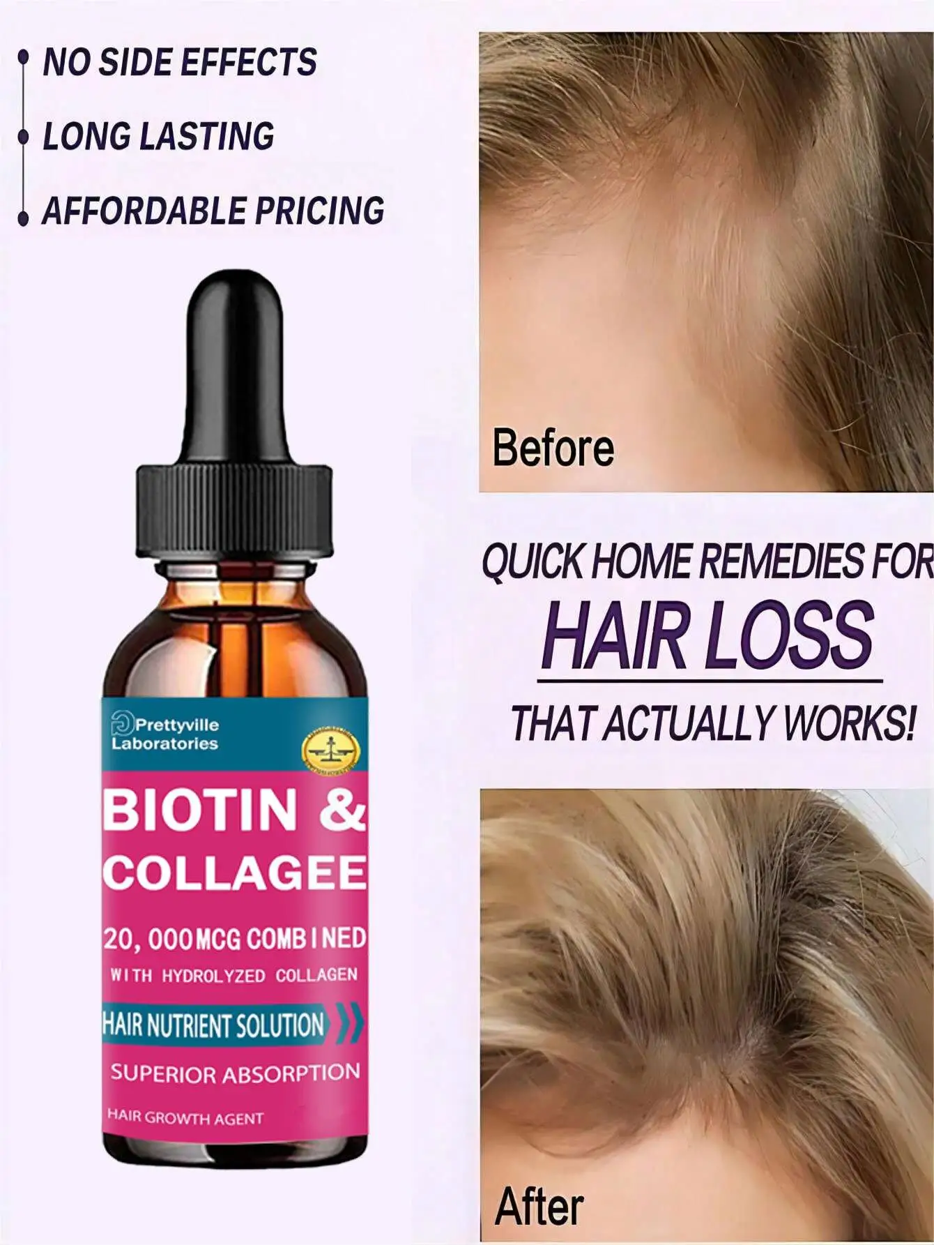 Hairloss Hair Alopecia Hair Treatment for Black Women Growth Oil Head Care Growth Spray