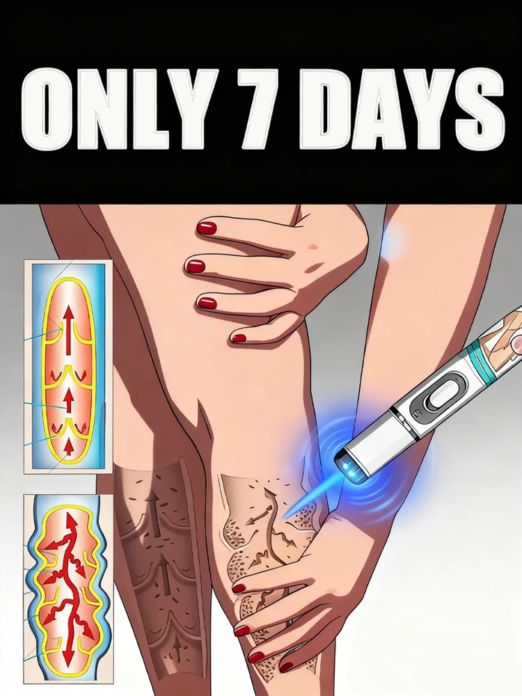 

Ручка Generation-2 Blue Light Says Goodbye To All Veins 7 дней