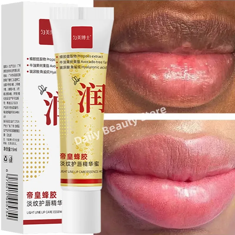 Remove Dark Lip Balm Fast Lightening Pink Lip Exfoliating Fade Lip Line Dead Skin Moisturizer Korean Care Products Beauty Health