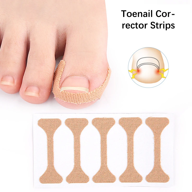 

5/15/30Pcs I -shaped Ingrown Toenail Corrector Strip Antifungal Nail Orthosis Sticker Foot Care Paronychia Tool Patch