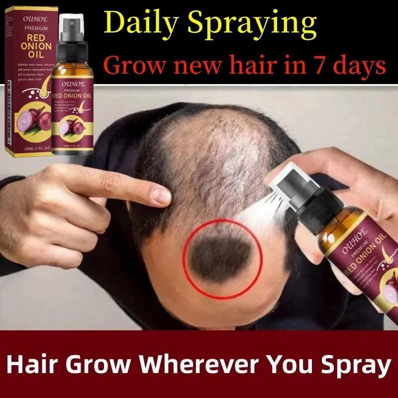 New Powerful Hair Growth Serum Spray Repair Hair Nourish Root Regrowth Hair Anti Hair Loss Essence Men Women Hair Care Products