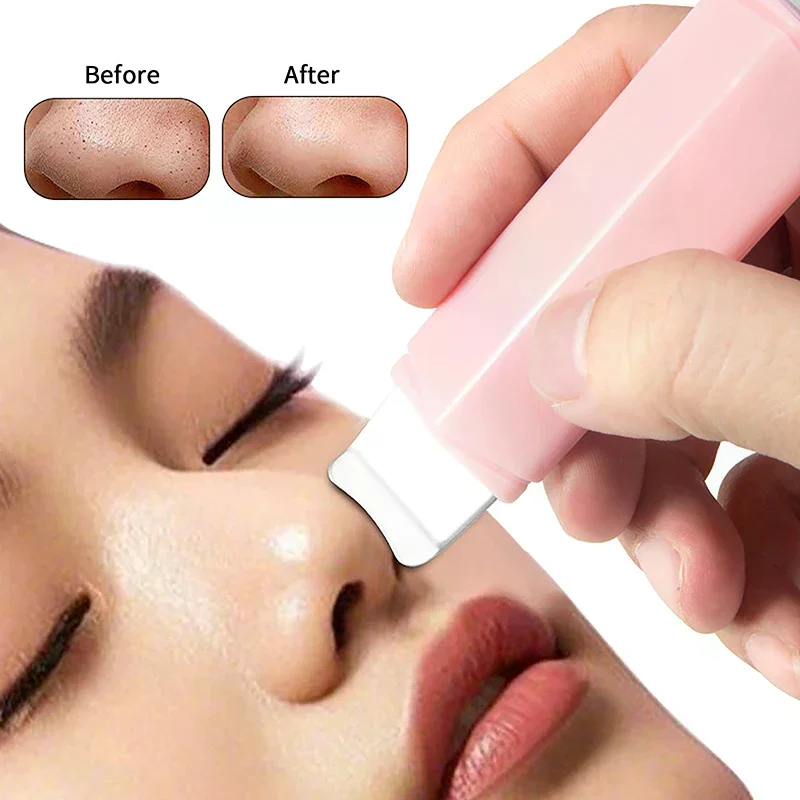Herramienta de eliminación de espinillas faciales de doble cabeza, raspador Facial para limpieza profunda, espátula Facial, eliminador de espinillas de nariz, herramienta de cuidado de la piel