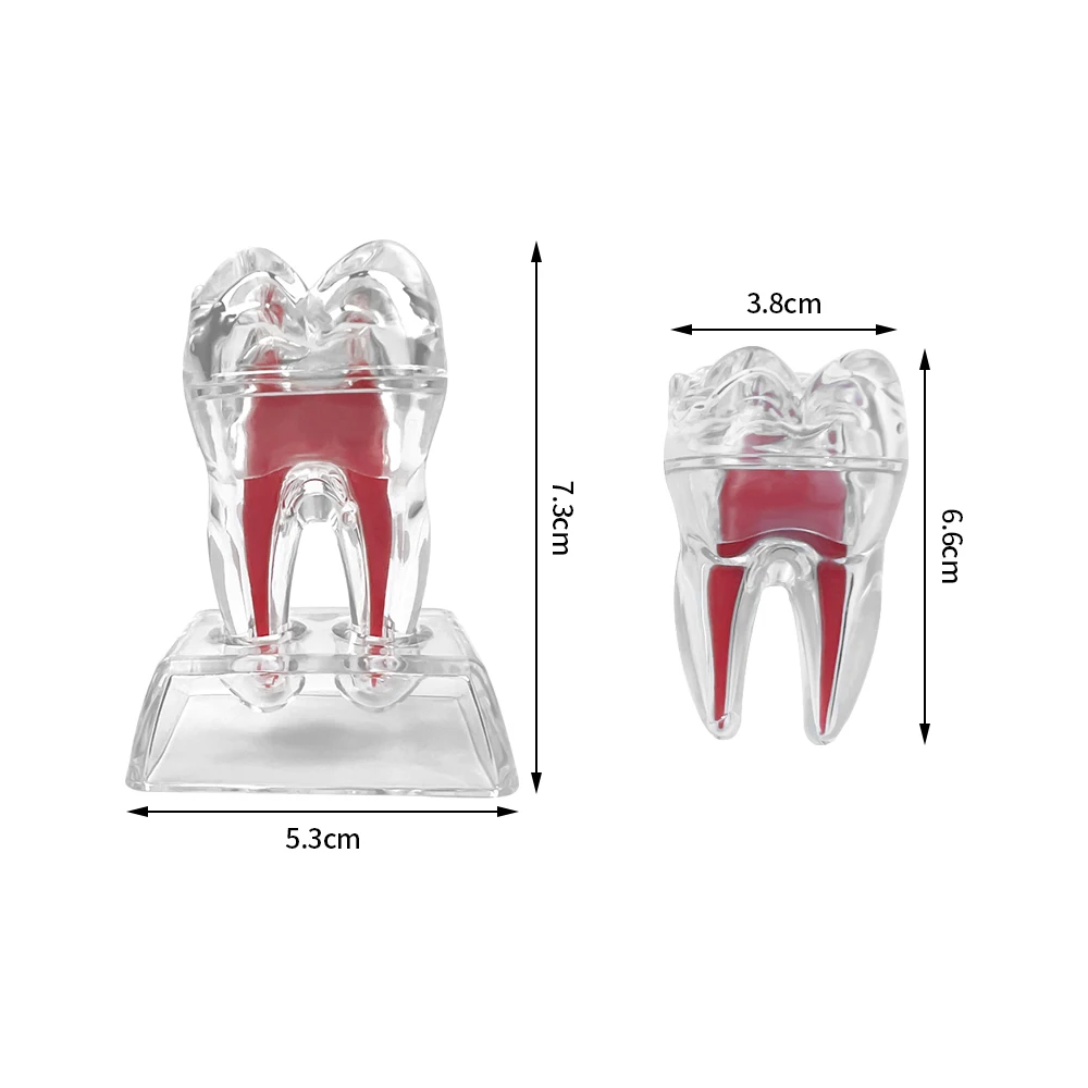 Modèle anatomique dentaire avec poignées transparentes, dents simples amovibles, modèle molaire de décomposition de la structure, modèles de démonstration de la dentisterie