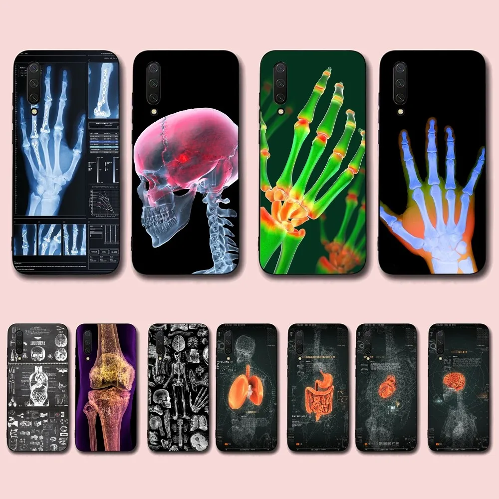 Radiological human organs Skeleton Phone Case For Xiaomi Mi 5X 8 9 10 11 12 lite pro 10T PocoX3pro PocoM3 Note 10 pro lite