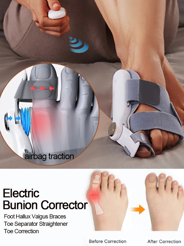 Electric Bunion Corrector Airbag Traction Vibration Orthopedic Foot Hallux Valgus Braces Rehabilitation Therapy Toe Correction