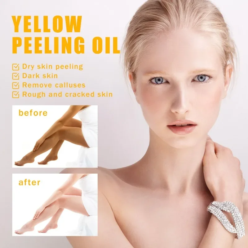 Yellow peeling oil strong exfoliating oil Lighten elbows knees Bleaching Dark melanin even skin tone and whiten Remove Dead skin