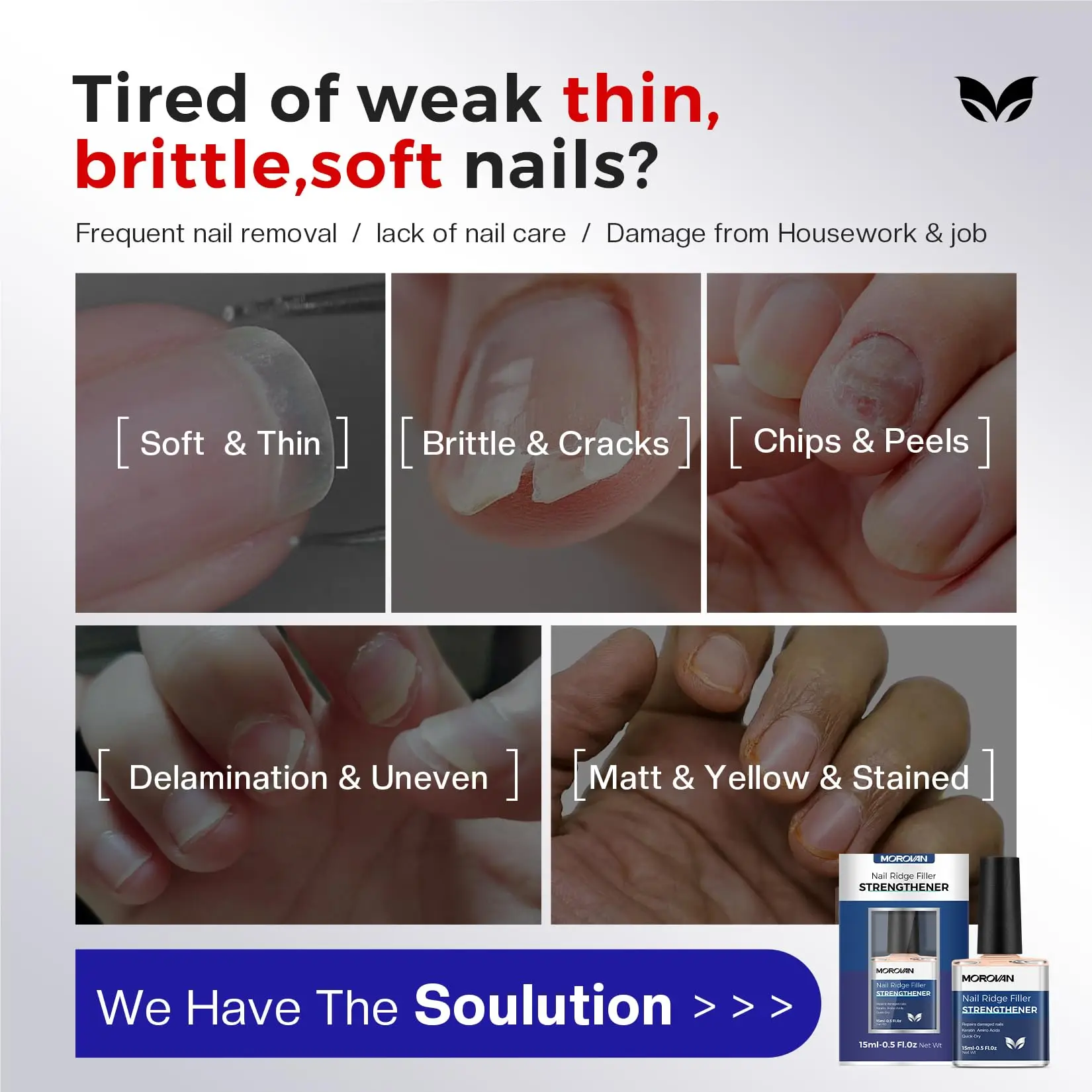 مقوي الأظافر والنمو: مقوي طلاء الأظافر لعلاج الأظافر التالفة، إصلاح طبيعي يمنع تكسير اللون