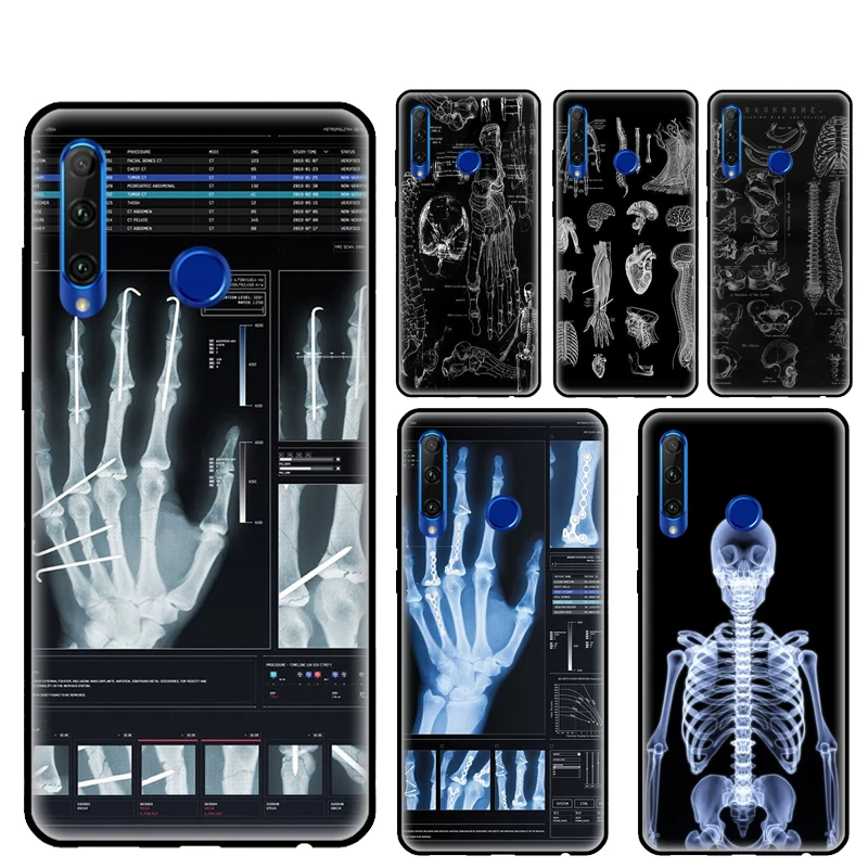 Radiological Human … - image