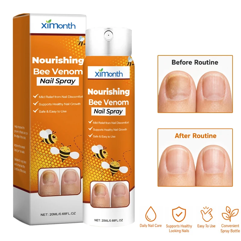 1pcs Nail Nourishing Spray 20ml Exfoliating Spray for Gentle Moisturizing Care Daily Nail Care Mist for Cuticles Fingertips