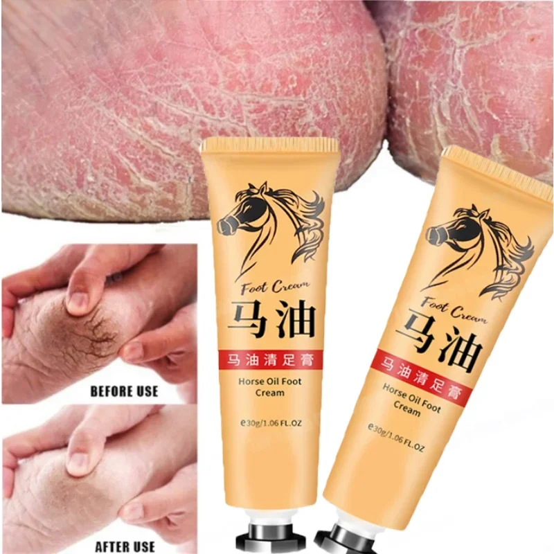 Anti-crack Moisture Hand Cream มือและเท้า Moisturizer โลชั่นทามือติดทนนาน Ultra Moisturizing ครีมบํารุงผิวปราศจากน้ําหอม