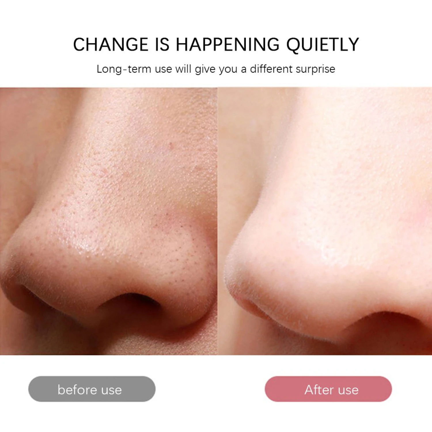 Ultrasonic Deep Cleansing Facial Cleanser for Gentle and Effective Blackhead Removal with Vibration Massage