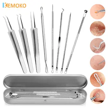 10 best sales عصا إزالة الرؤوس السوداء - №7